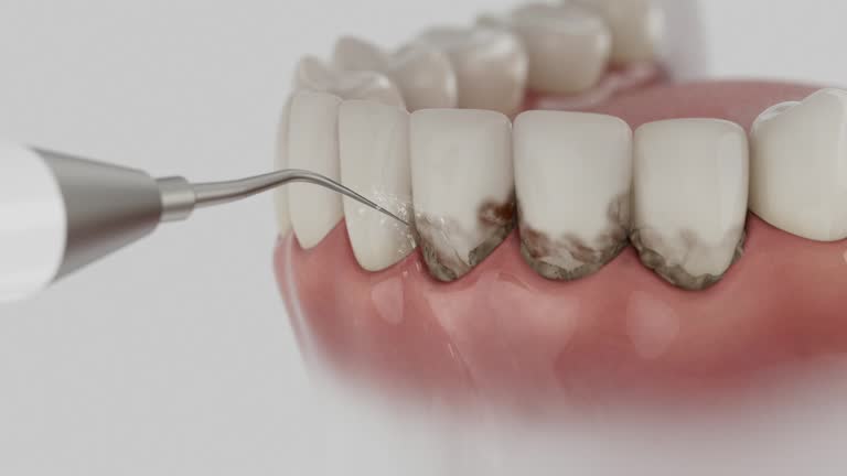 Trusted Emergency Dentist service in Harrison, NY - Dentist Open Now